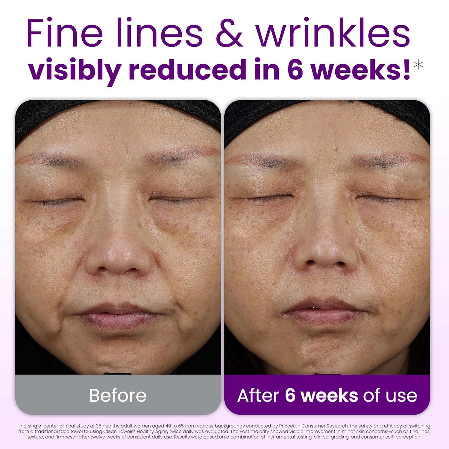 Reduce Fine Lines & Wrinkles i - огляд і ціна Xl Skincare